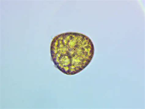 Fern Spores Under A Microscope Rs Science
