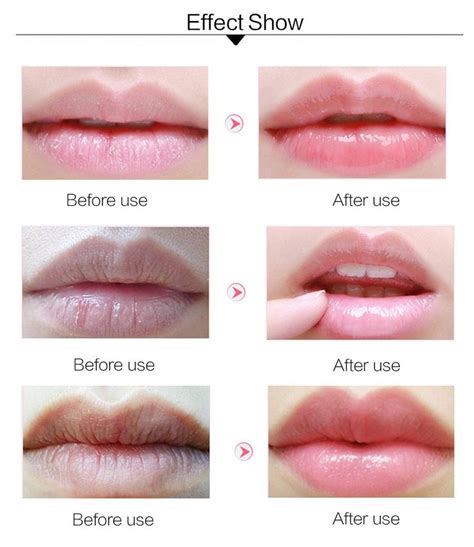 Moisturizing Lips Lip Moisturizer