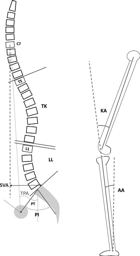 illustration of measurements of spinal pelvic global and lower limb download scientific