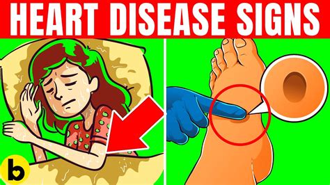15 Early Warning Signs Of Heart Disease You Should Lookout For Youtube