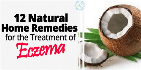 12 Natural Home Remedies For The Treatment Of Eczema — Healing Through