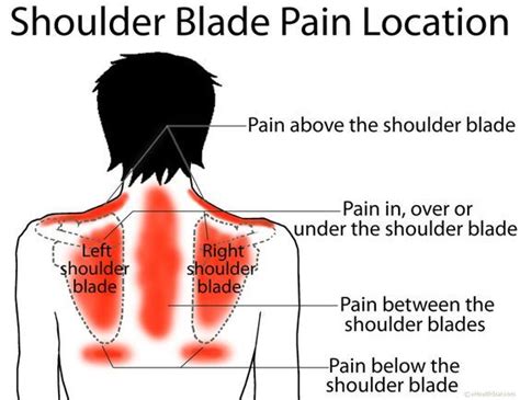 Shoulder Blade Pain Location Left Right Under Between Picture How