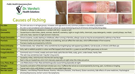 Itching Causes