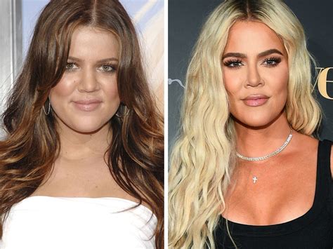 Khloe Kardashian Confirms What Surgery She S Had Done During KUWTK Reunion