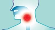 Acid reflux can lead to a sore throat. GERD and Your Throat: Esophageal Damage, Complications ...
