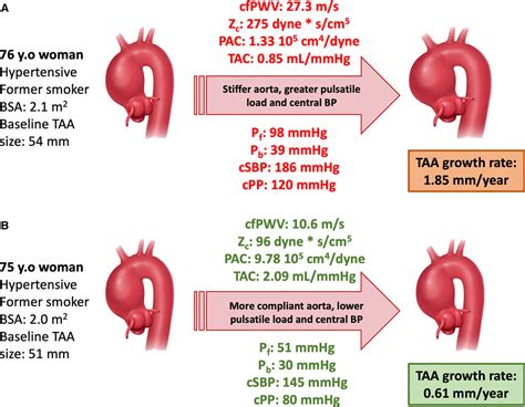 Aortic Stiffness Central Blood Pressure And Pulsatile Arterial Load