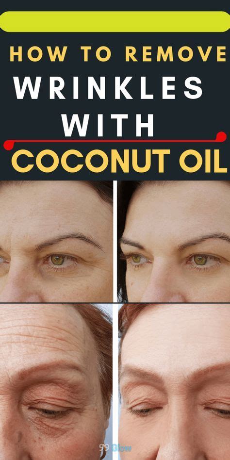 How To Remove Wrinkles With Coconut Oil Wrinkle Remedies Wrinkle