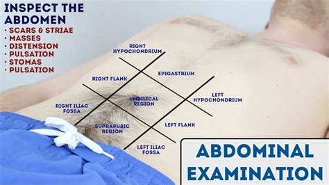 Abdominal Examination Osce Guide New Release Abdominal Free