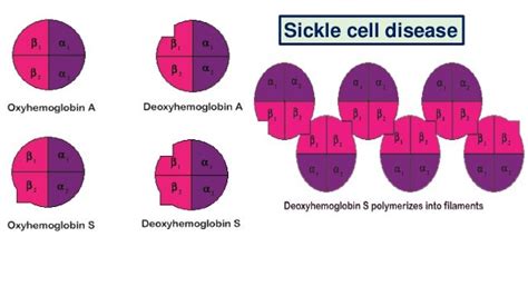 Sickle Cell Anemia Final