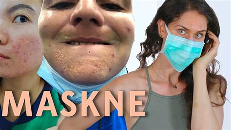 Mask Acne What You Need To Know Maskne Youtube