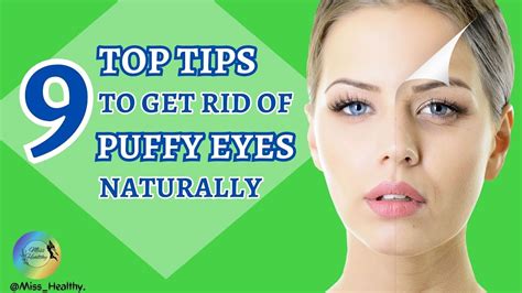 How To Get Rid Of Under Eye Bags Fast Naturally Under Eye Bags Treatment Miss Healthy Youtube