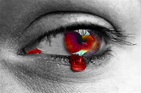 Bleeding Eye By Flauschvampire91 On Deviantart