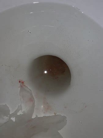 Implantation Bleeding In Toilet