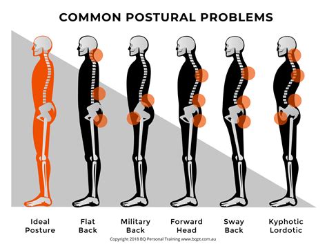 Posture Problems