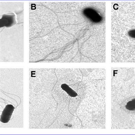 Transmission Electron Microscopy Micrographs Of Salmonella Enteritidis