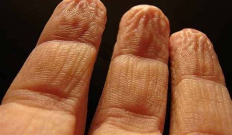 why do fingers wrinkle or ‘prune in water wrinkle finger prune