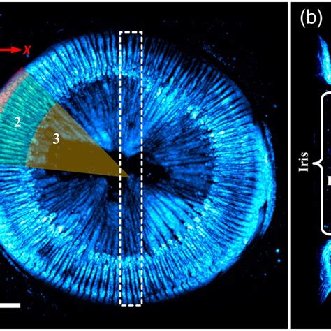 Pdf Delineating The Anatomy Of The Ciliary Body Using Hybrid Optical