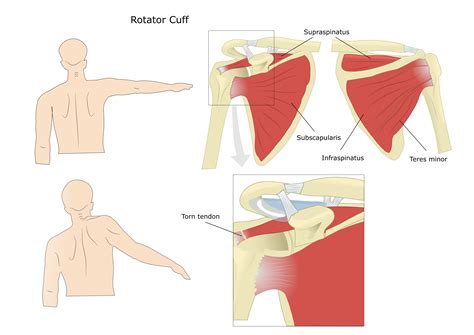 What Is The Rotator Cuff Larson Sports And Orthopaedics
