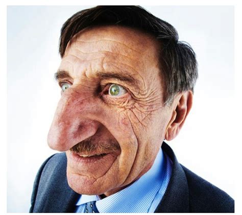 Check Out Viral Photos Of The Man With The Longest Nose In The World