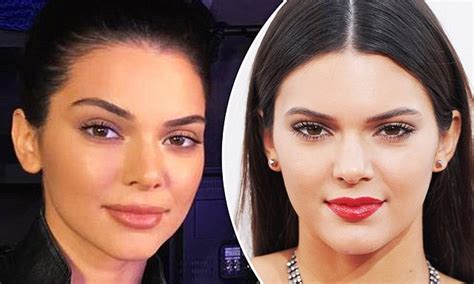 Kendall Jenner Denies Having Plastic Surgery And Getting Lip Fillers Daily Mail Online