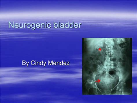 Ppt Neurogenic Bladder Powerpoint Presentation Free Download Id834467