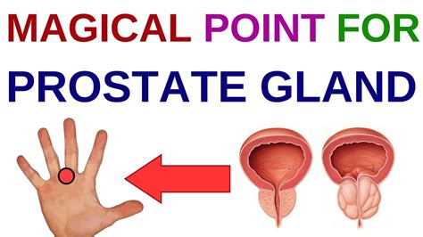 Acupressure Points For Prostateprostate Enlargementprostate Problemssujok Therapy For