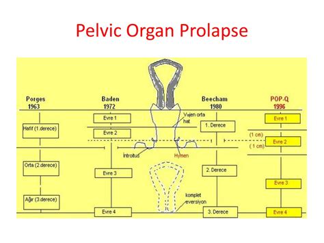 Ppt Pelvic Floor And Functional Anatomy Powerpoint Presentation Free Download Id 9472689