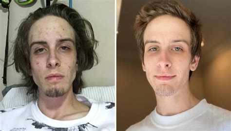 Former Drug Addict Shares Inspiring Before And After Photos To Show Toll Addiction Takes On