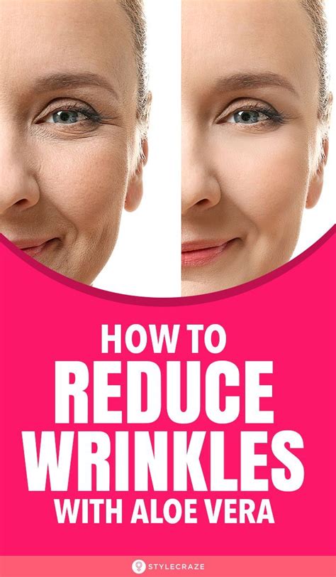 5 Ways To Reduce Wrinkles With Aloe Vera Reduce Wrinkles Healthy