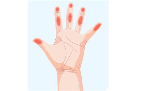 7 Important Things Your Hands Can Reveal About Your Health Page 3 Of