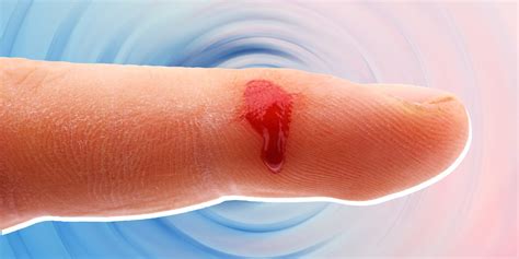 Heres How To Tell If You Have An Infected Cut And What To Do About It