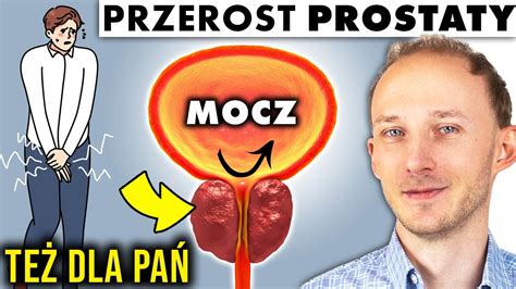 Metod Na Przerost Prostaty Prostata Objawy Rozrostu Dr Bartek Kulczy Ski Youtube
