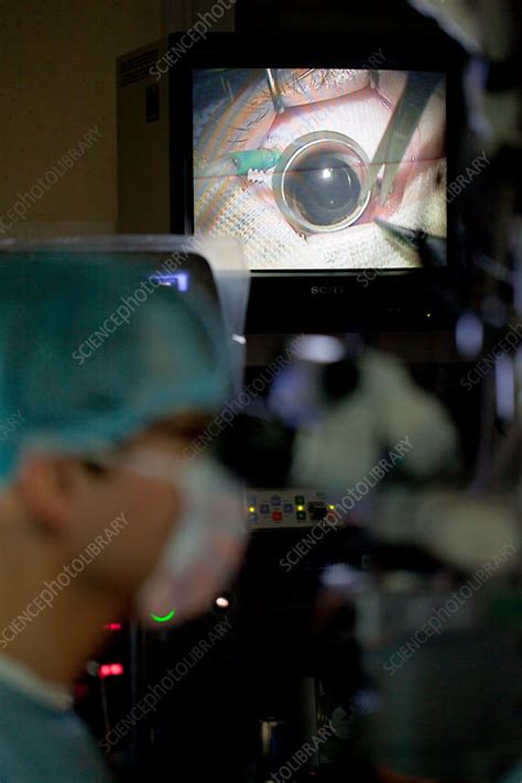 Gene Therapy Surgery For Blindness Stock Image C0301646 Science