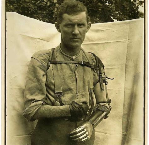 A World War I Veteran With A Prosthetic Arm Rredorchestra