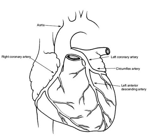 Arteries of the trunk include the. Cardiac Catheterization, Heart Cath, Angiography, Stents, Attack