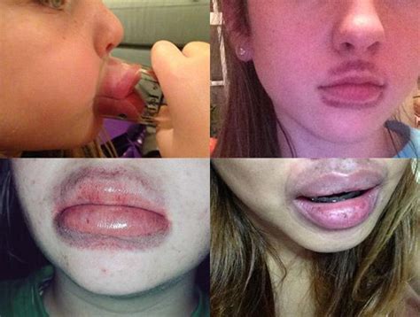 Kylie Jenner Lip Challenge Fails On Twitter And Instagram Kylie