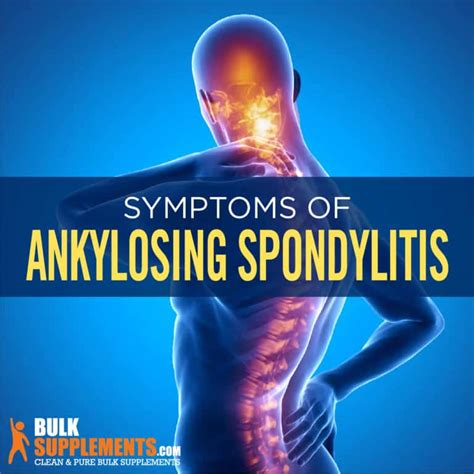 Ankylosing Spondylitis Symptoms Causes And Treatments