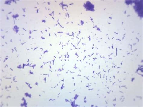 Eisco Prepared Microscope Slide Coccus Smear Gram Positive