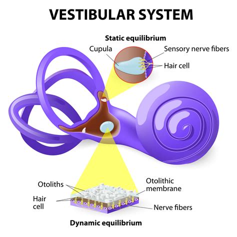 Vestibular Neuritis Symptoms Causes And Physical Therapy Management