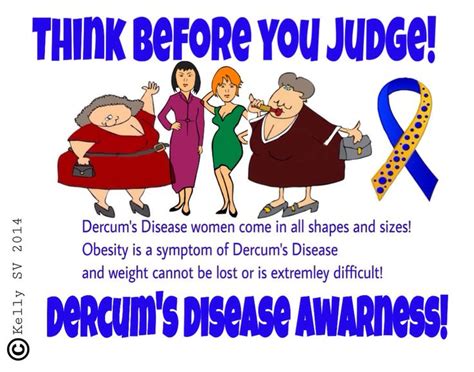 Pin On Adiposis Dolorosa Also Known As Dercums Disease Is A Rare
