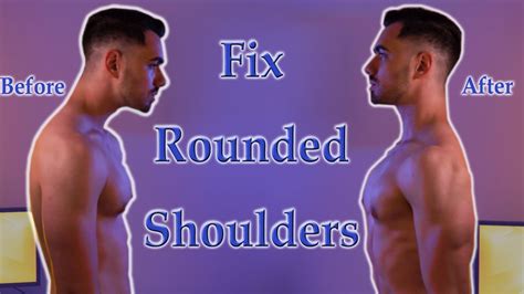 How Can You Fix Rounded Shoulders Develop A New Posture Simple Fix