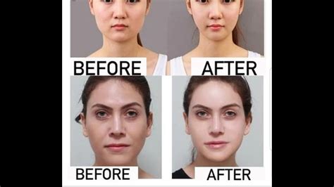 9 Effective Exercises To Slim Down Your Face Youtube