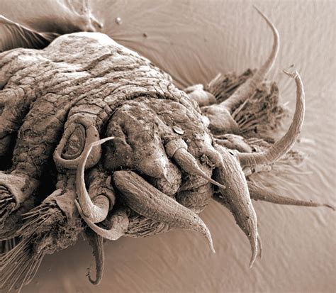 Incredible Examples Of Electron Microscope Photography Twistedsifter