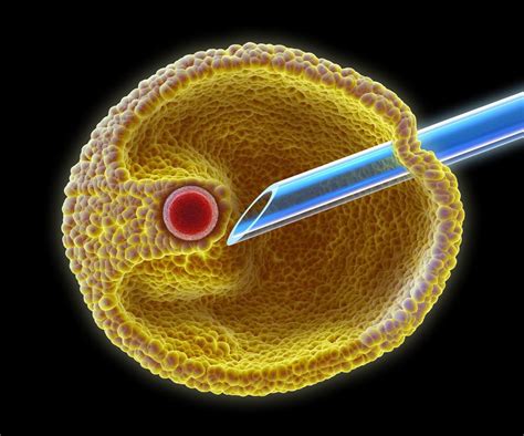 Fécondation in vitro les différentes étapes en images