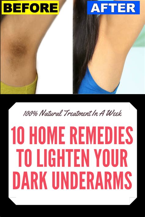 10 Home Remedies To Lighten Your Dark Underarms In A Week