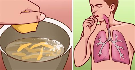 8 Home Remedies To Treat Bronchitis And Stop Painful Coughing Attacks