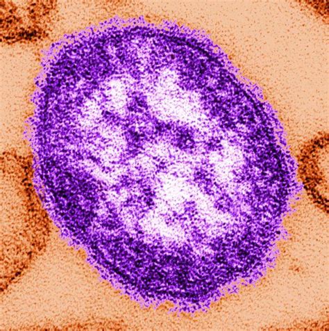 Distemper virus
