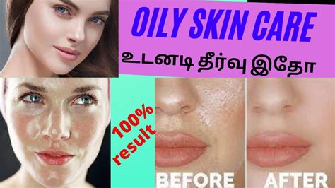 How To Remove Oily Skin Youtube