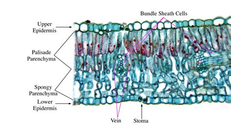 Pinus Leaf Cross Section Labeled