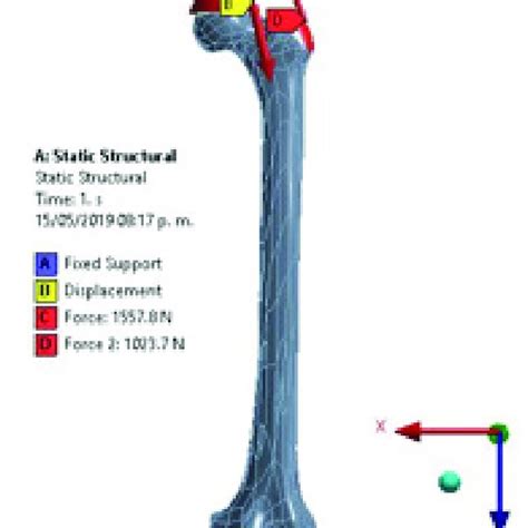 Gruen Zones Considered For A Standard Femoral Implant Download